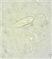 Hydra oligactis (Pallas, 1766)